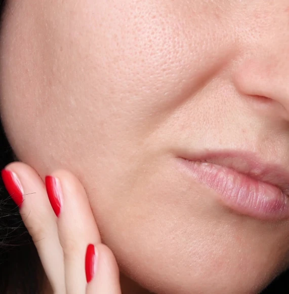 Enlarged-Pores-red-nails-Page