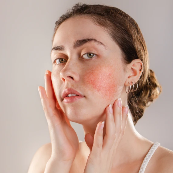 girl-with-bun-and-extremely-red-cheeks