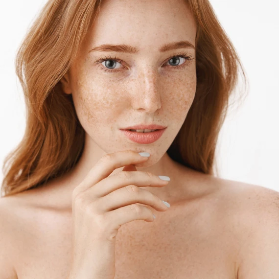 red-head-with-freckles